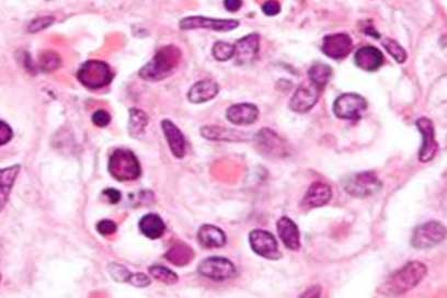 Parvo virus